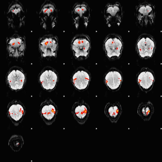 Signal BOLD — Wikipédia