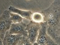 Vidéomicroscopie — Wikipédia