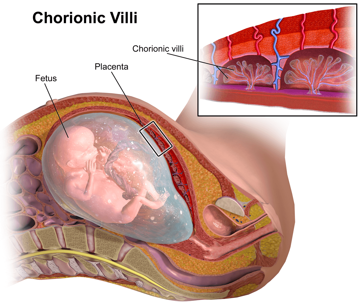Chorionic villi - Wikipedia