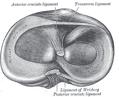 Meniscus tear - Wikipedia