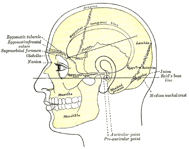 Mastoiditis - Wikipedia