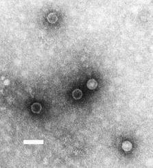 Entérovirus — Wikipédia