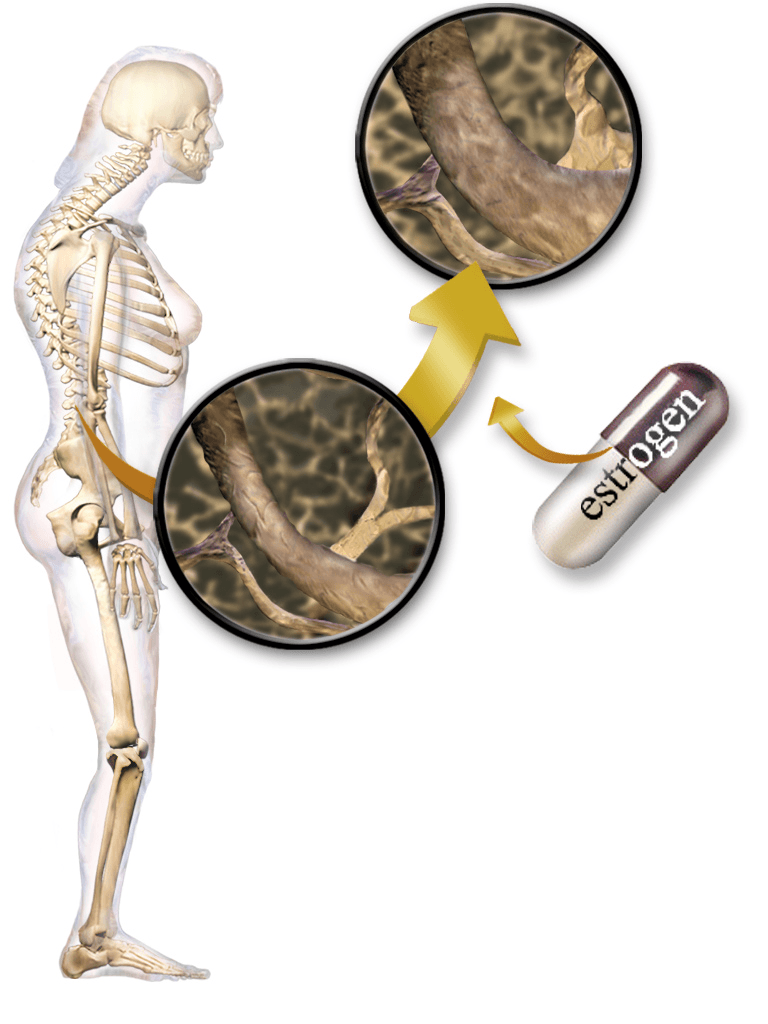 Hormone replacement therapy - Wikipedia